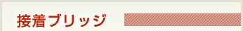 接着ブリッジ